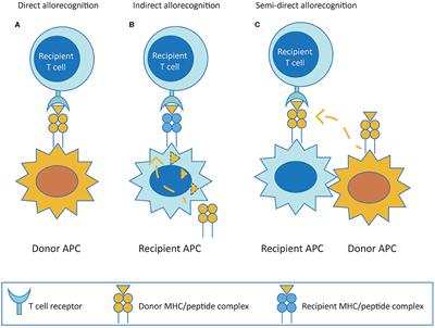 Pre-existing Alloreactive T and B Cells and Their Possible Relevance for Pre-transplant Risk Estimation in Kidney Transplant Recipients